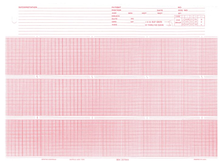 Recording Chart Paper Burdick™ Thermal 215 mm X 150 Foot Roll Red Grid